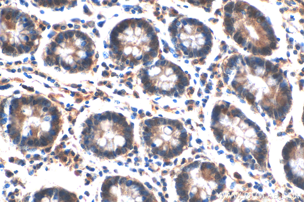 IHC staining of human stomach using 20725-1-AP