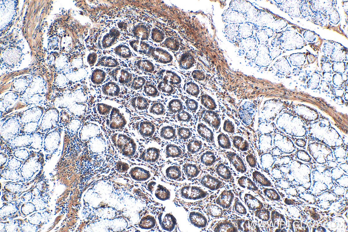 IHC staining of human stomach using 20725-1-AP