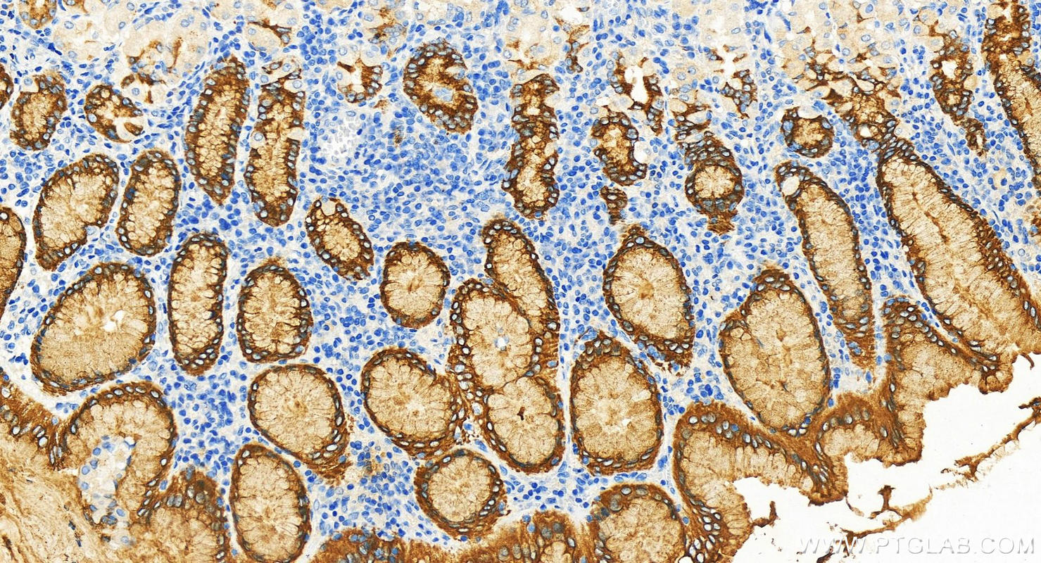 IHC staining of human stomach using 30408-1-AP