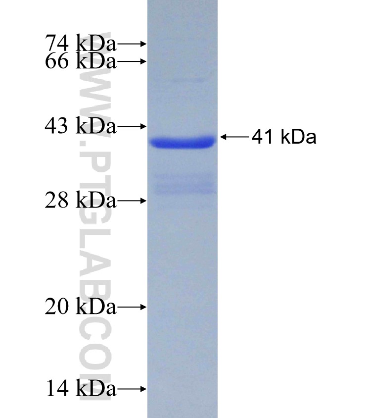 MUC5AC fusion protein Ag30190 SDS-PAGE