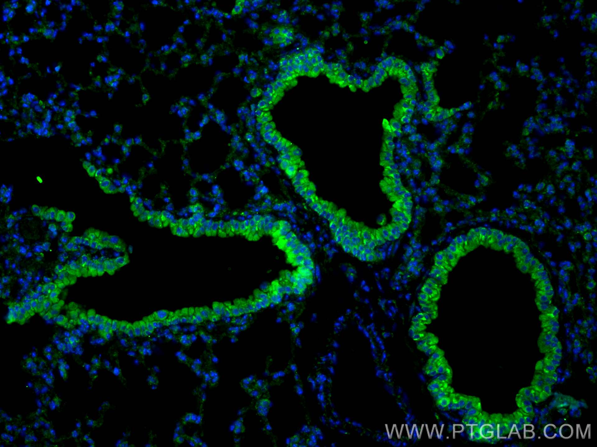 IF Staining of mouse lung using 28118-1-AP