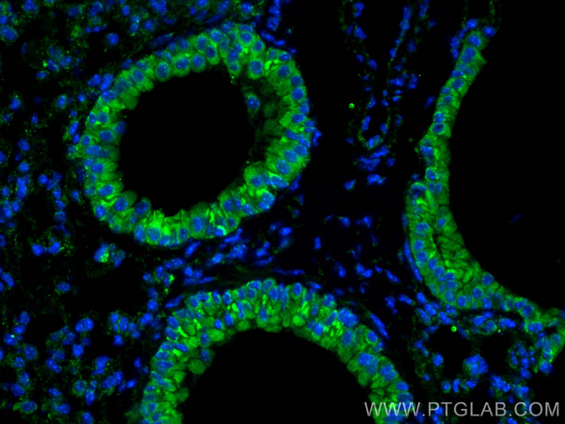 IF Staining of mouse lung using 28118-1-AP