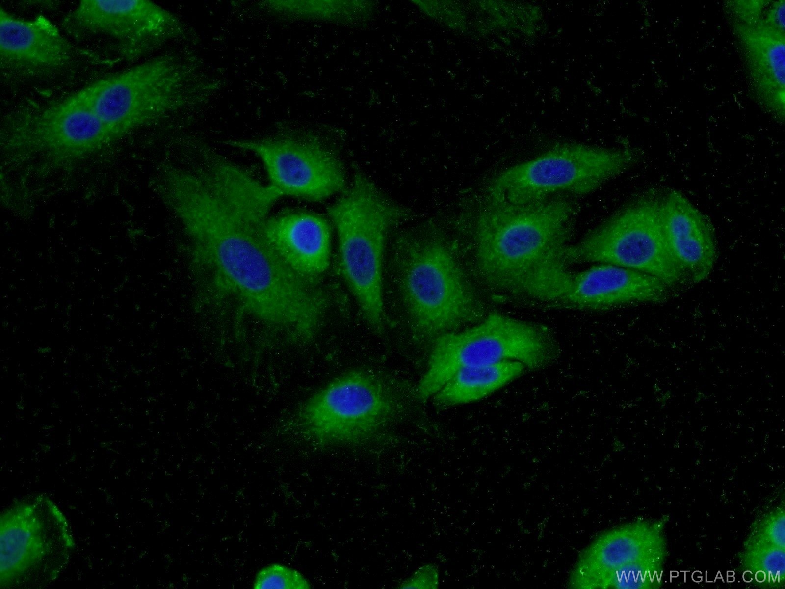 IF Staining of A549 using 55489-1-AP