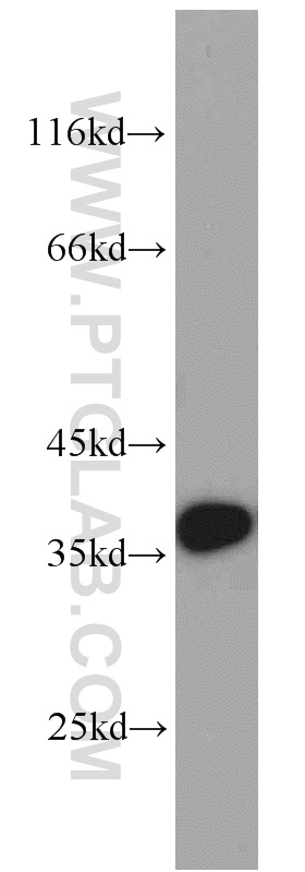 WB analysis of A549 using 55489-1-AP