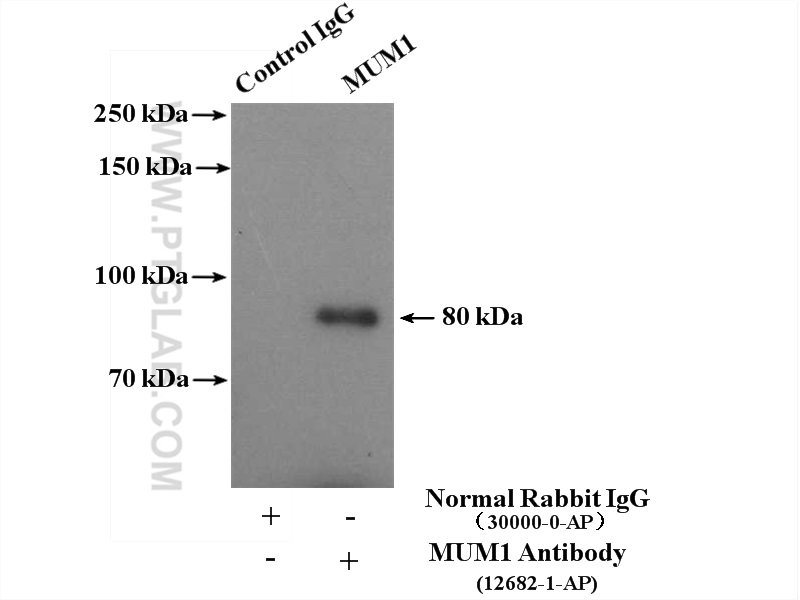 IP experiment of Jurkat using 12682-1-AP