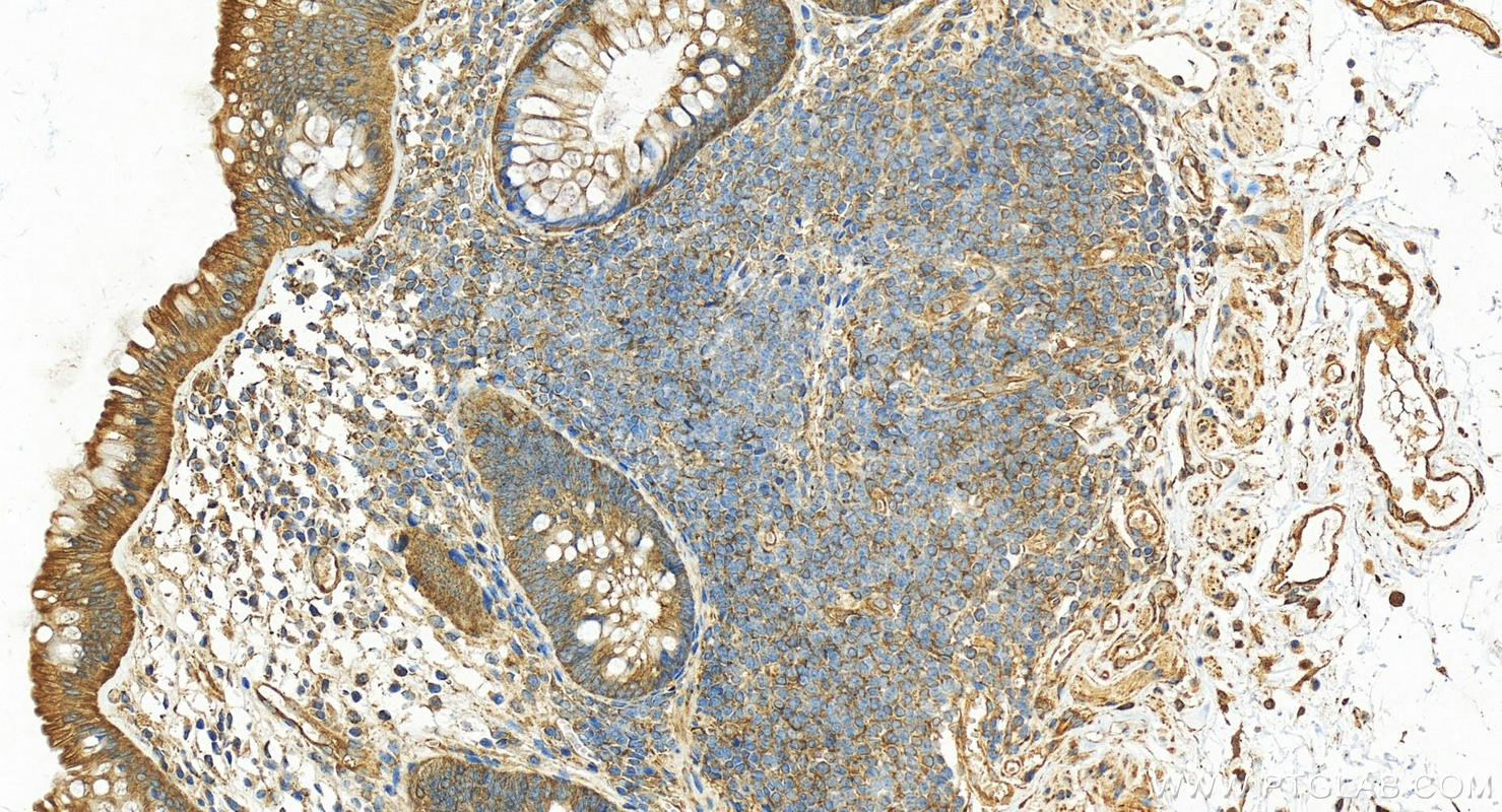 IHC staining of human normal colon using 16478-1-AP