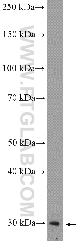 WB analysis of SH-SY5Y using 12360-1-AP