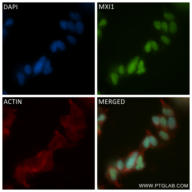 IF Staining of SH-SY5Y using 84733-6-RR