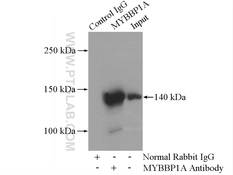 IP experiment of HEK-293 using 14524-1-AP