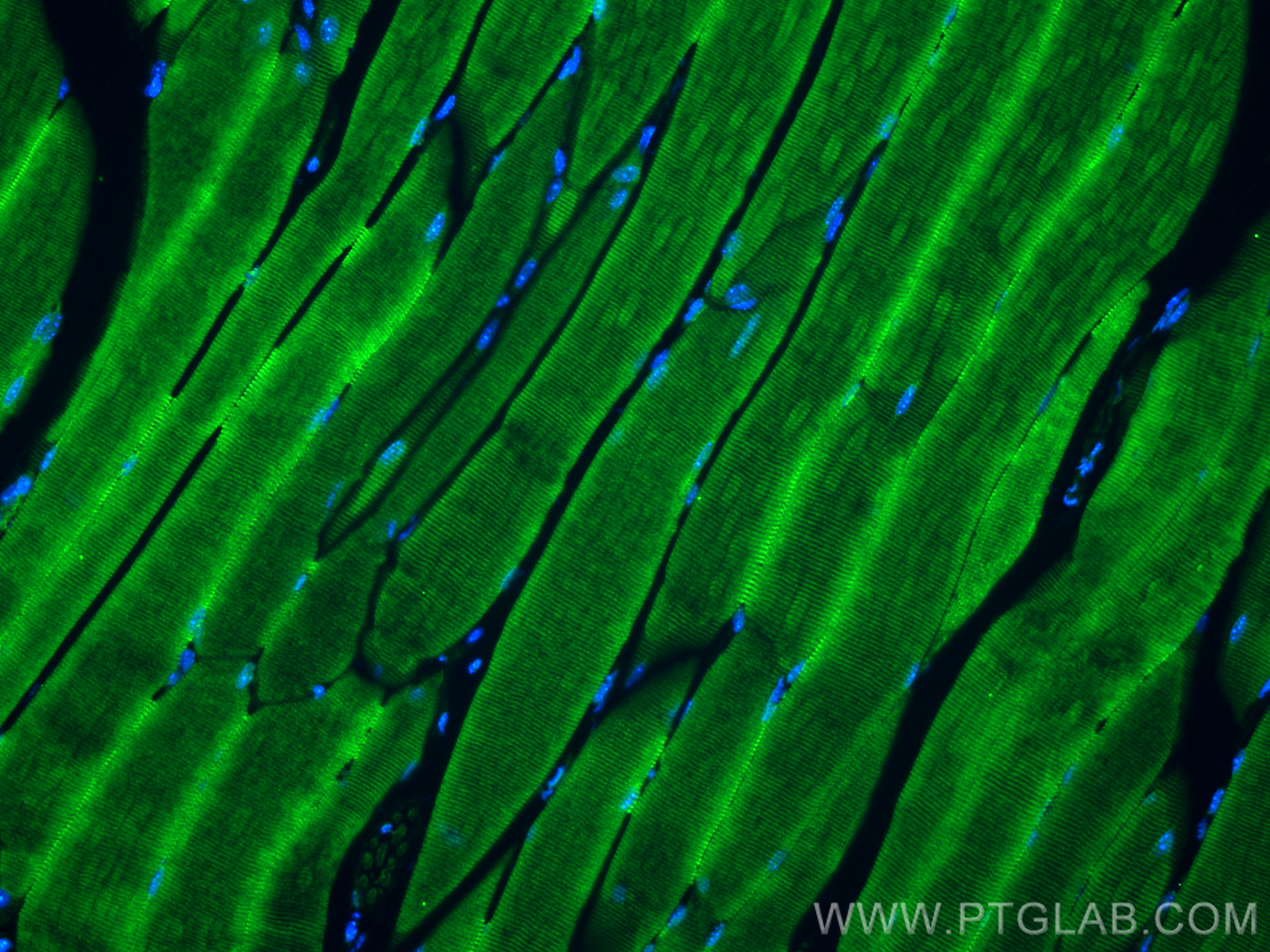 IF Staining of mouse skeletal muscle using 25257-1-AP