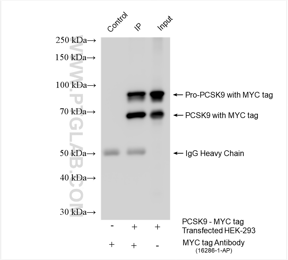 IP experiment of Transfected HEK-293 using 16286-1-AP