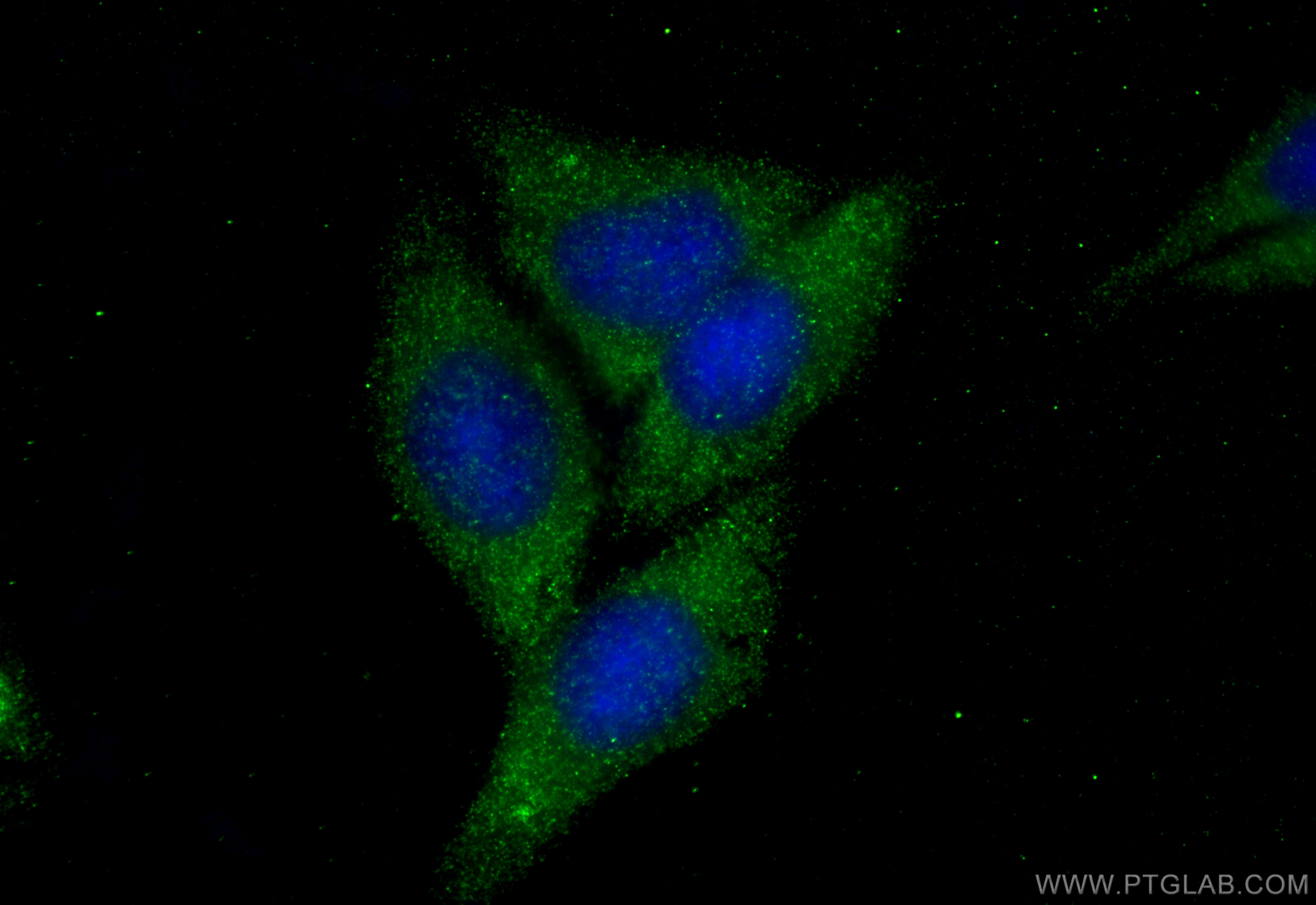 IF Staining of HepG2 using 12022-1-AP