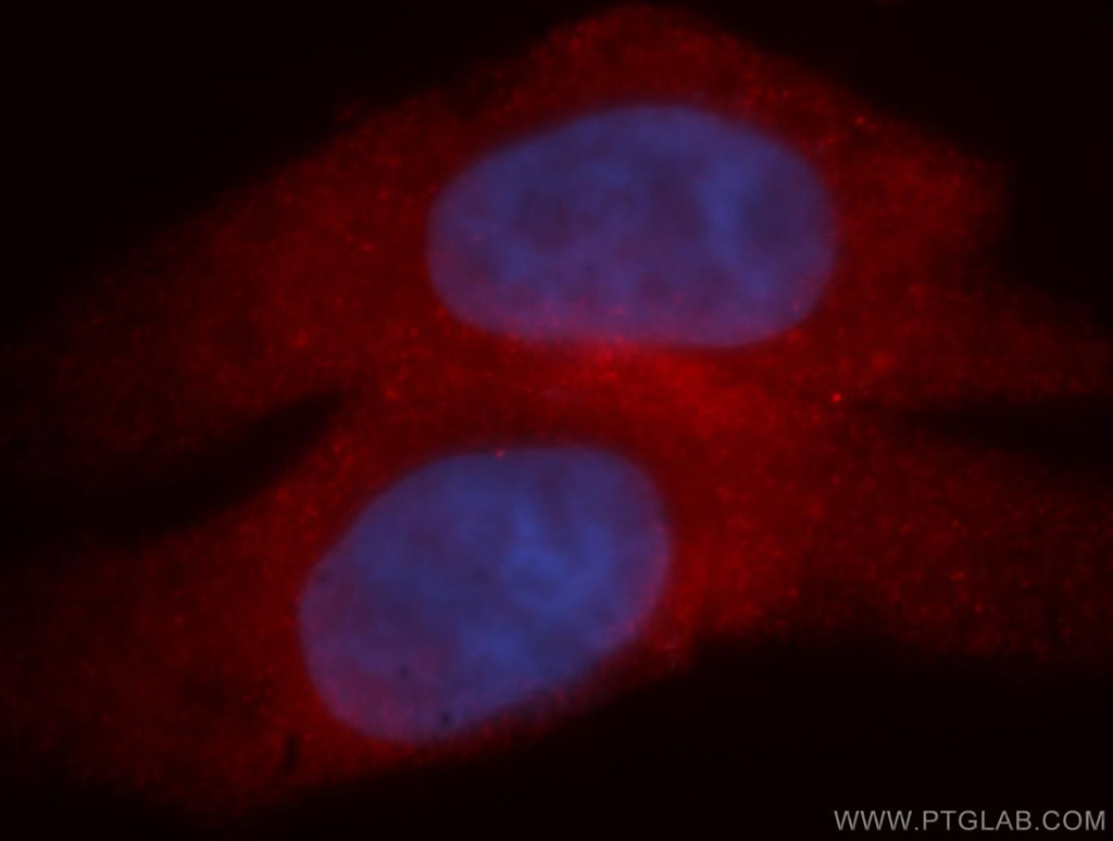 IF Staining of HepG2 using 12022-1-AP