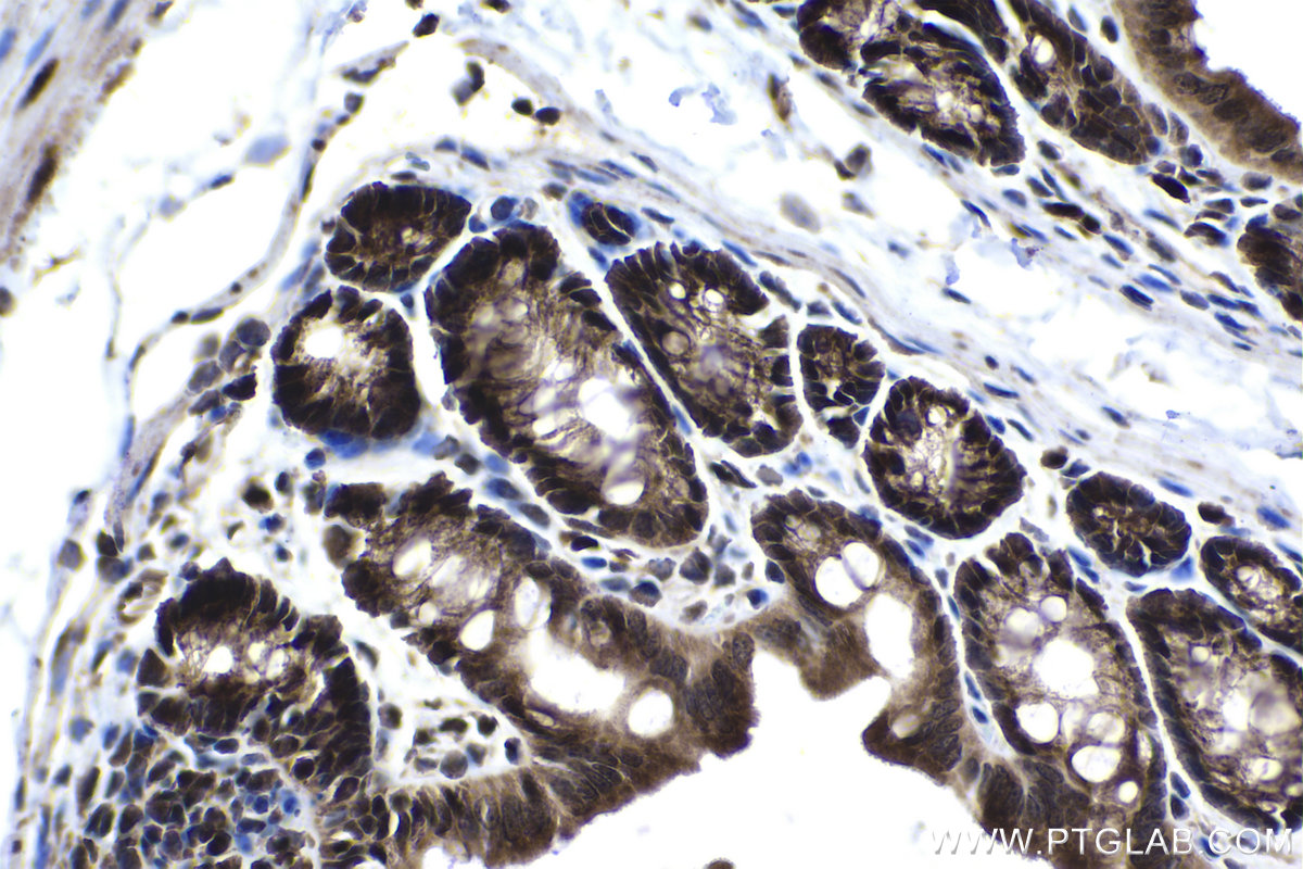 IHC staining of mouse colon using 12022-1-AP