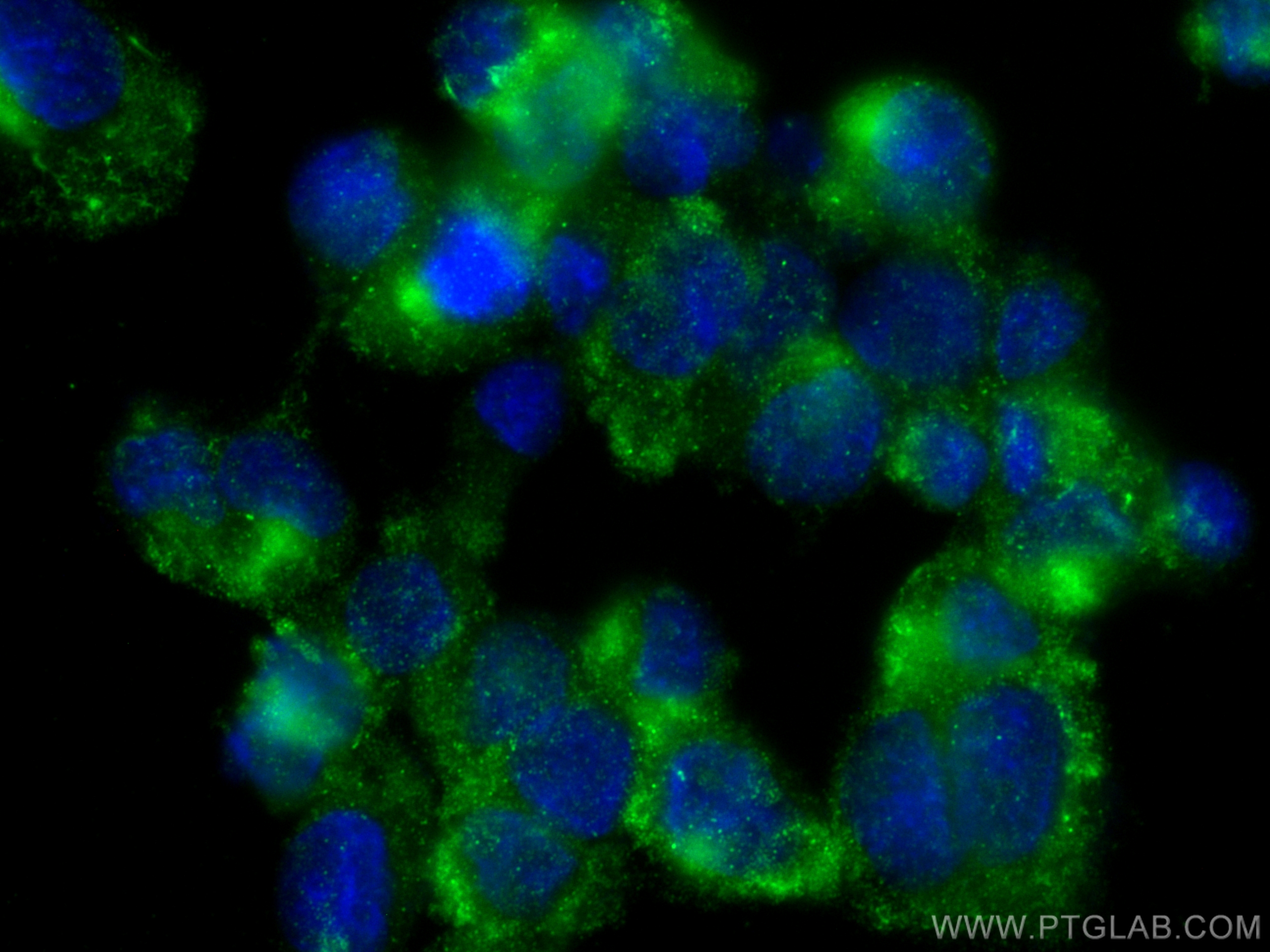 IF Staining of HUVEC using 12763-1-AP