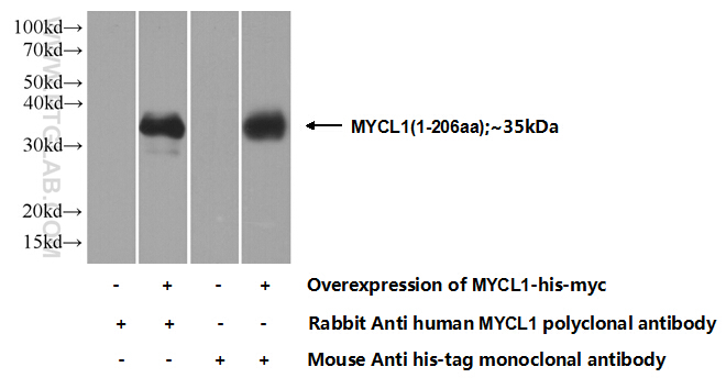 L-Myc