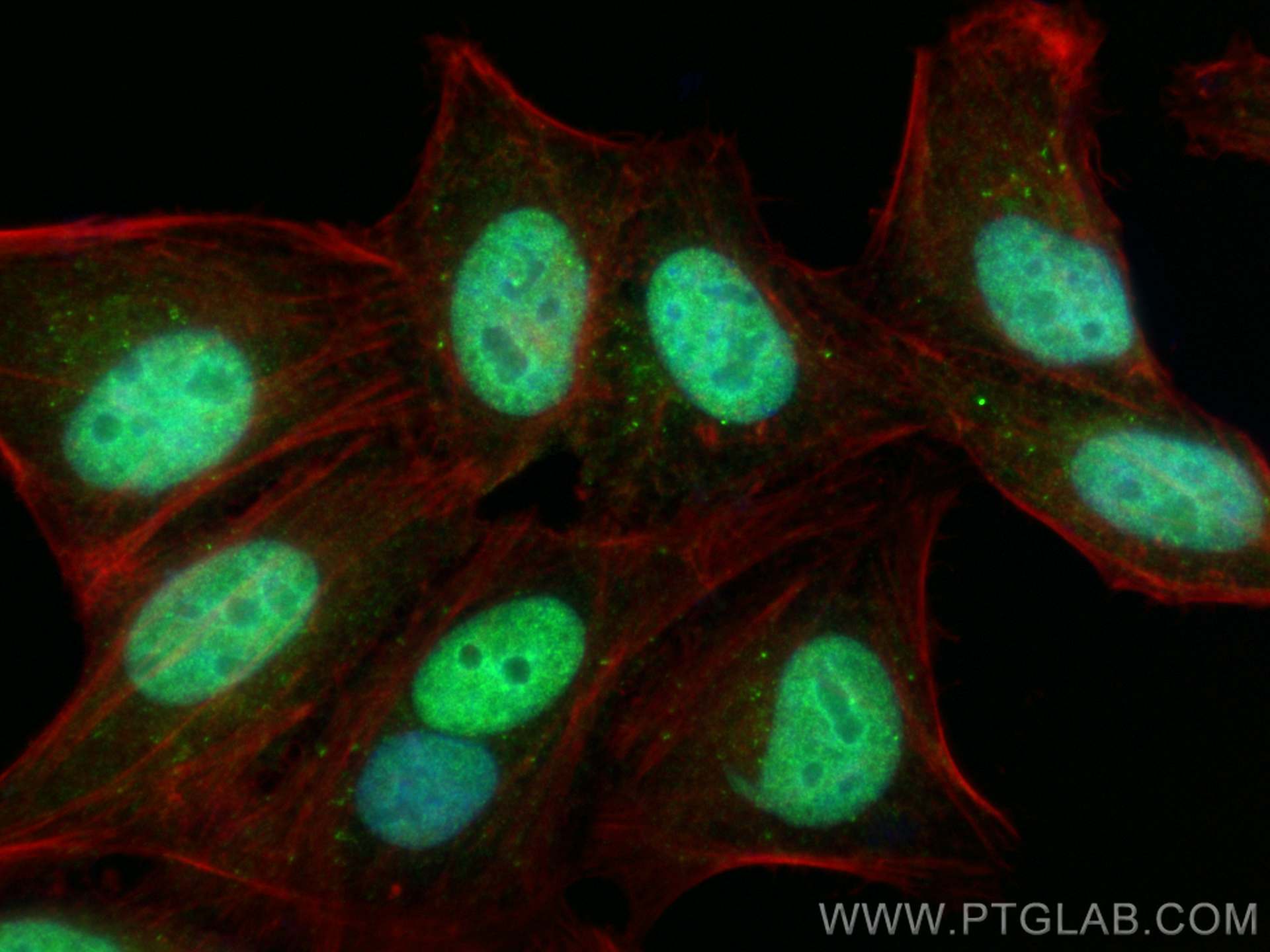 IF Staining of HepG2 using 16051-1-AP