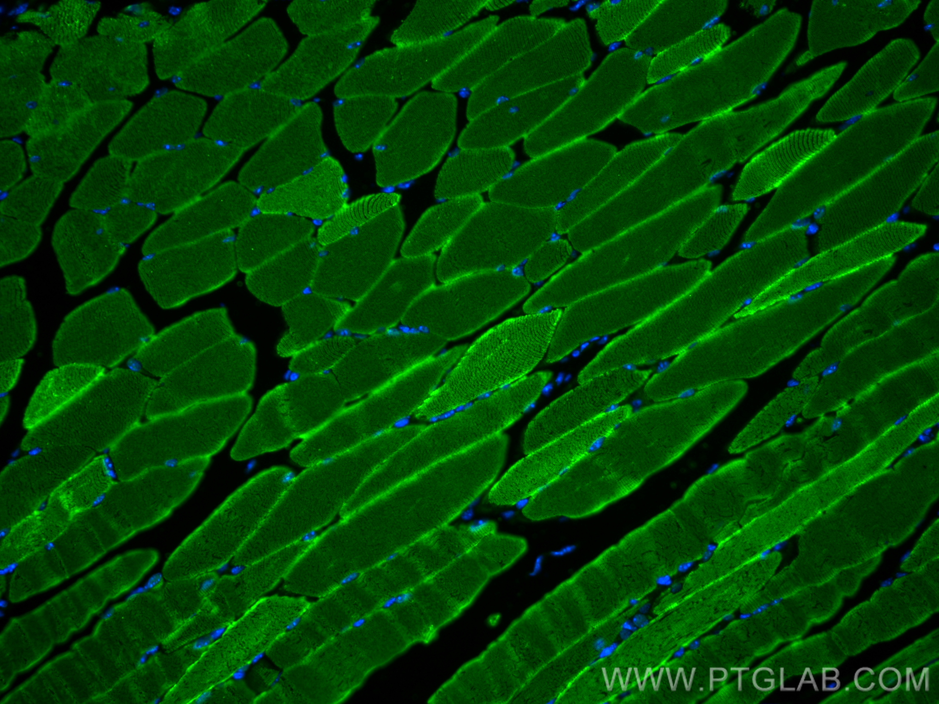 IF Staining of mouse skeletal muscle using 25182-1-AP