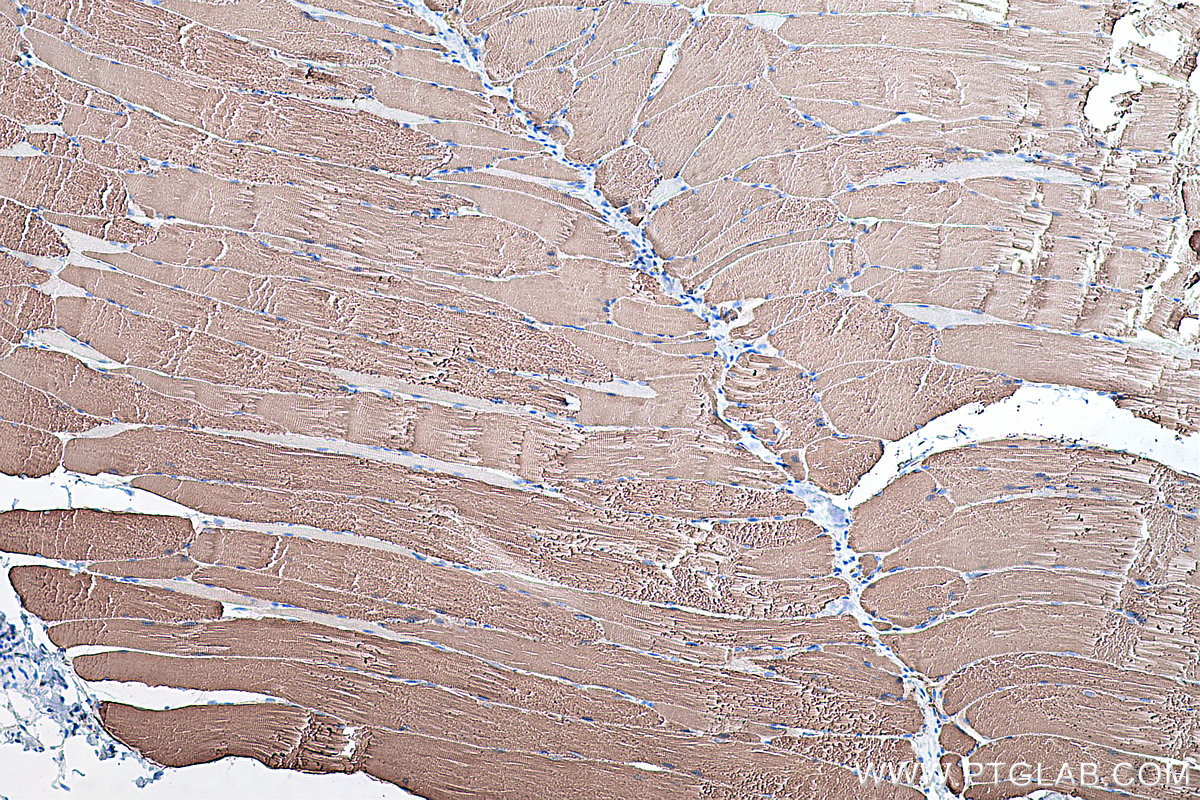 IHC staining of rat skeletal muscle using 67299-1-Ig