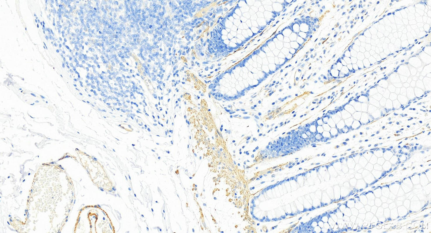 IHC staining of human normal colon using 18569-1-AP