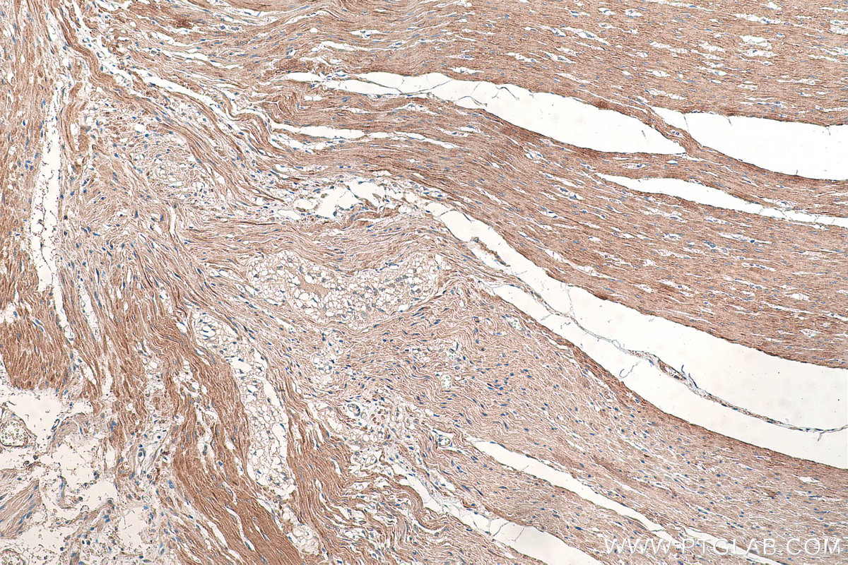 IHC staining of human colon using 60222-1-Ig