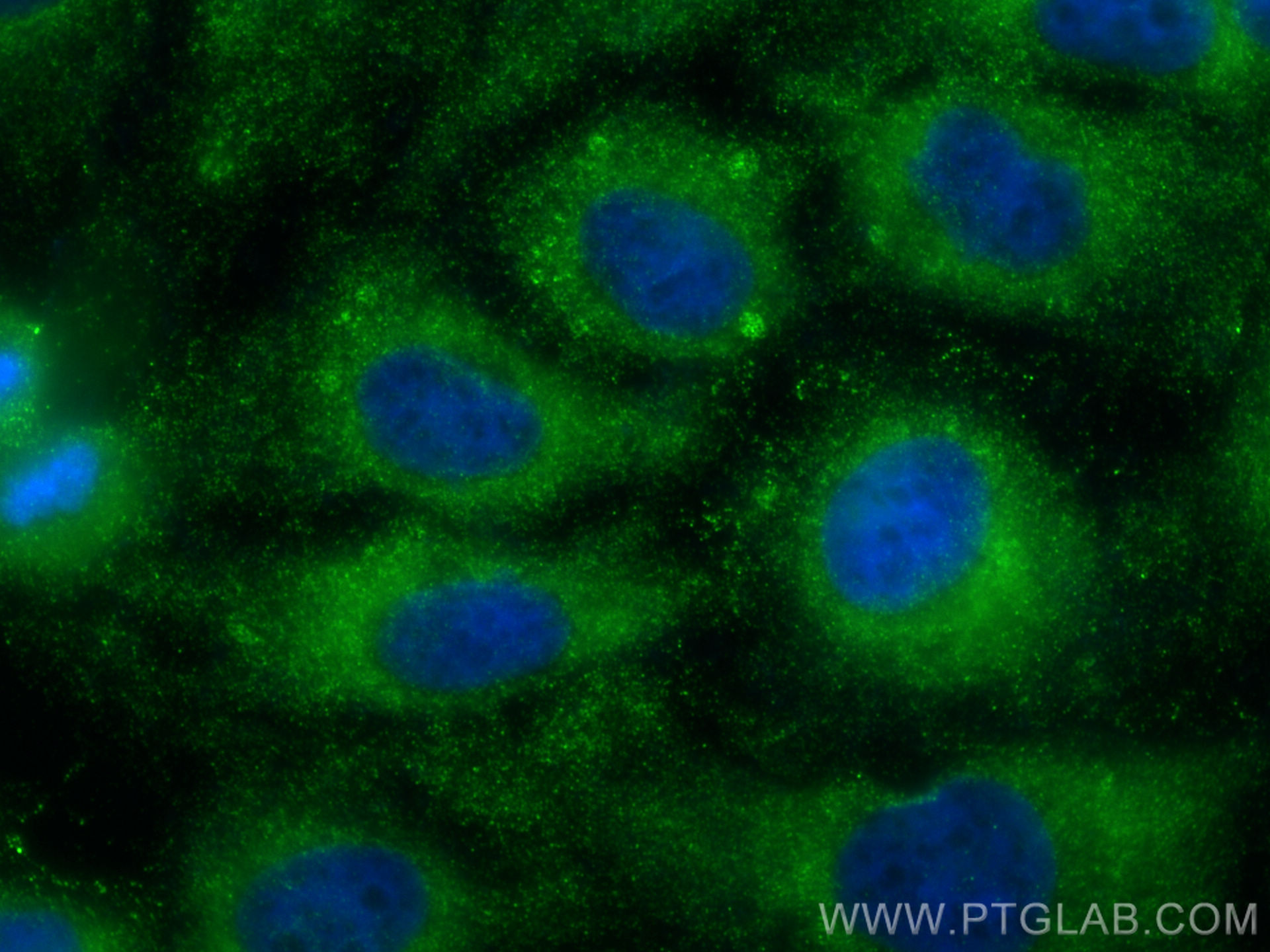 IF Staining of HeLa using 20716-1-AP