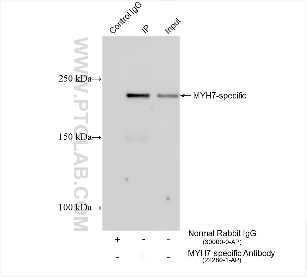 IP experiment of mouse heart using 22280-1-AP