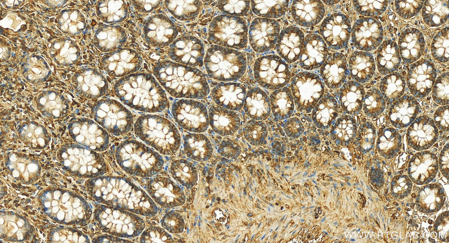 IHC staining of human normal colon using 11128-1-AP