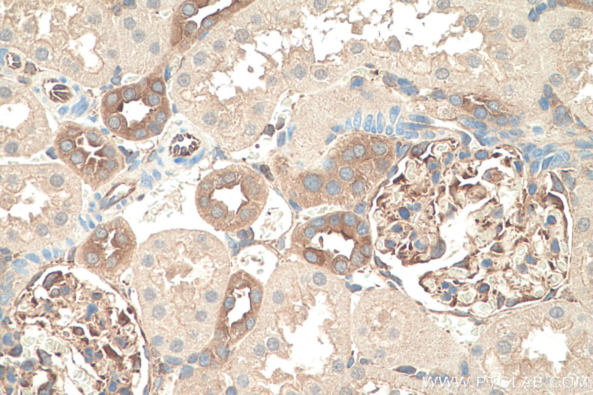 IHC staining of rat kidney using 81204-1-RR (same clone as 81204-1-PBS)