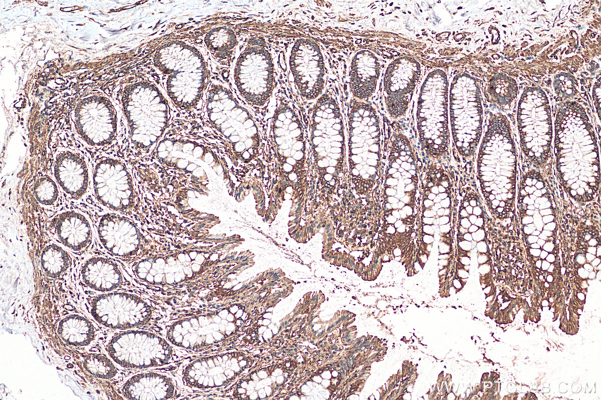 IHC staining of human colon using 10324-1-AP