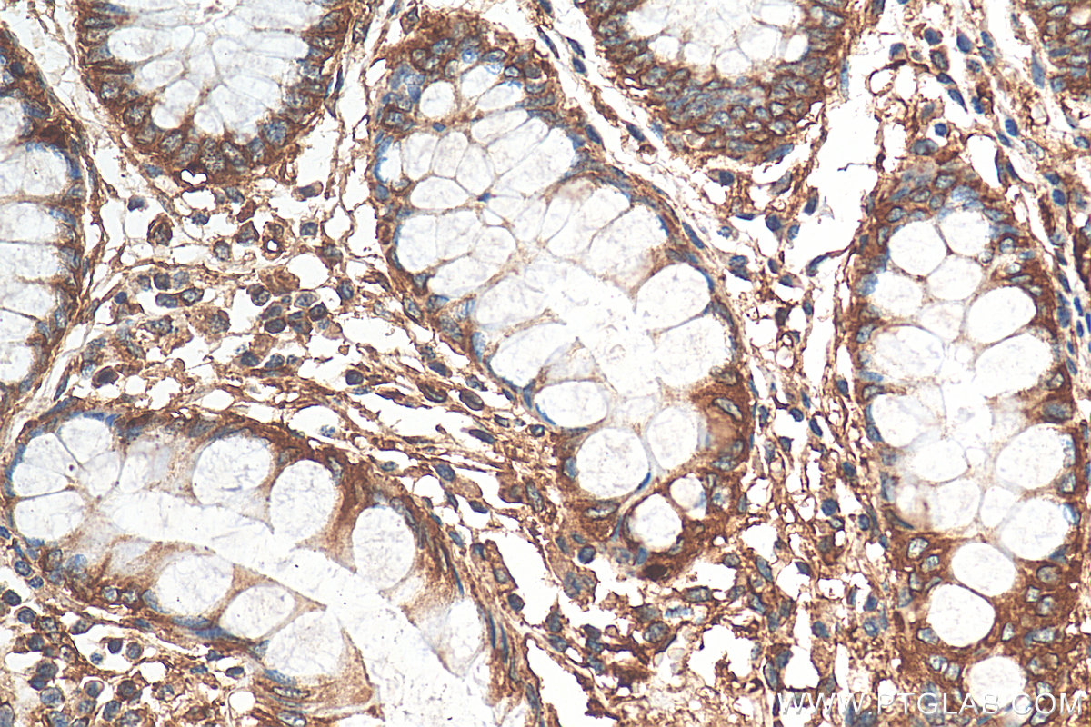 IHC staining of human colon using 10324-1-AP