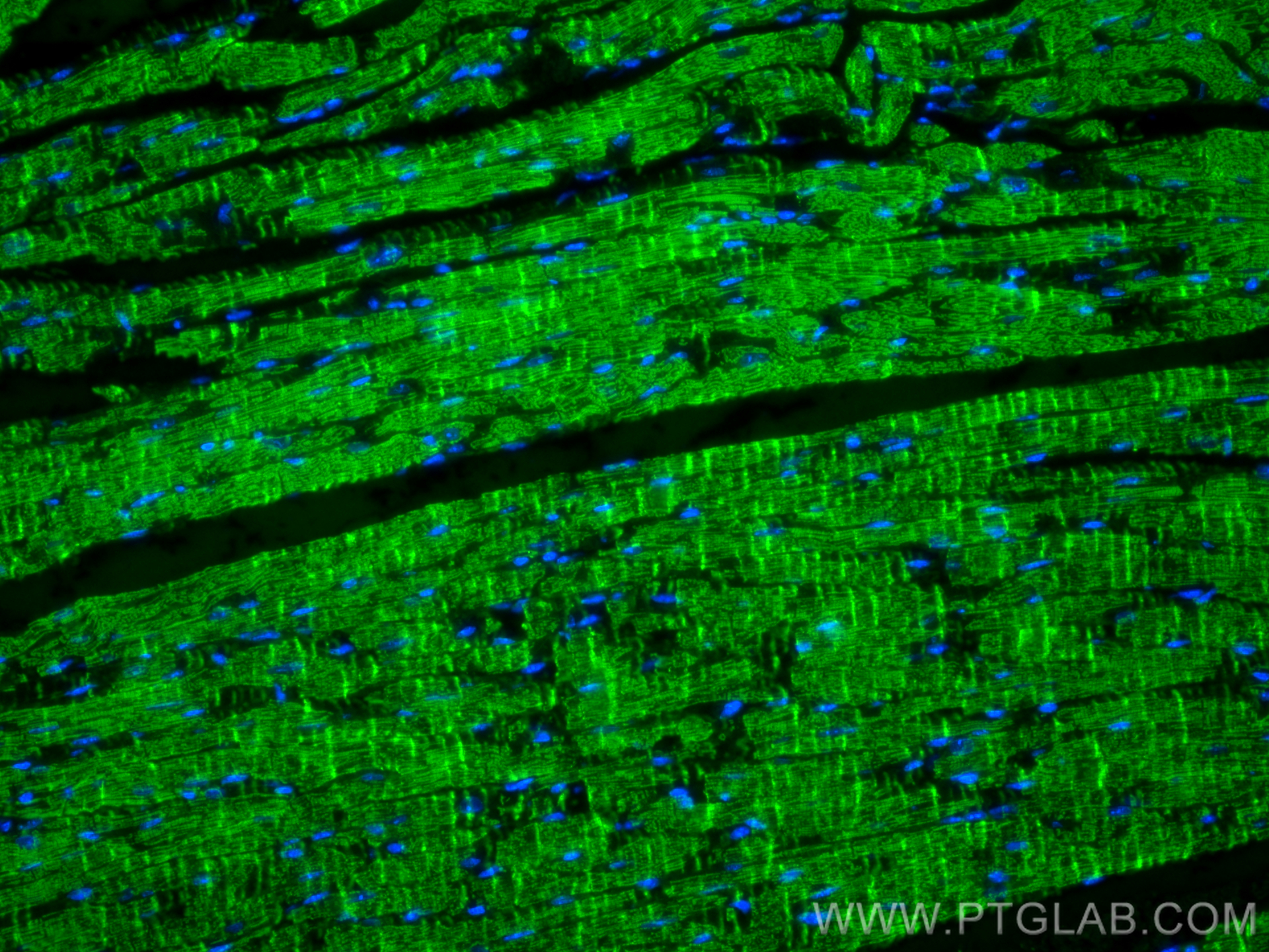 IF Staining of mouse heart using 10906-1-AP