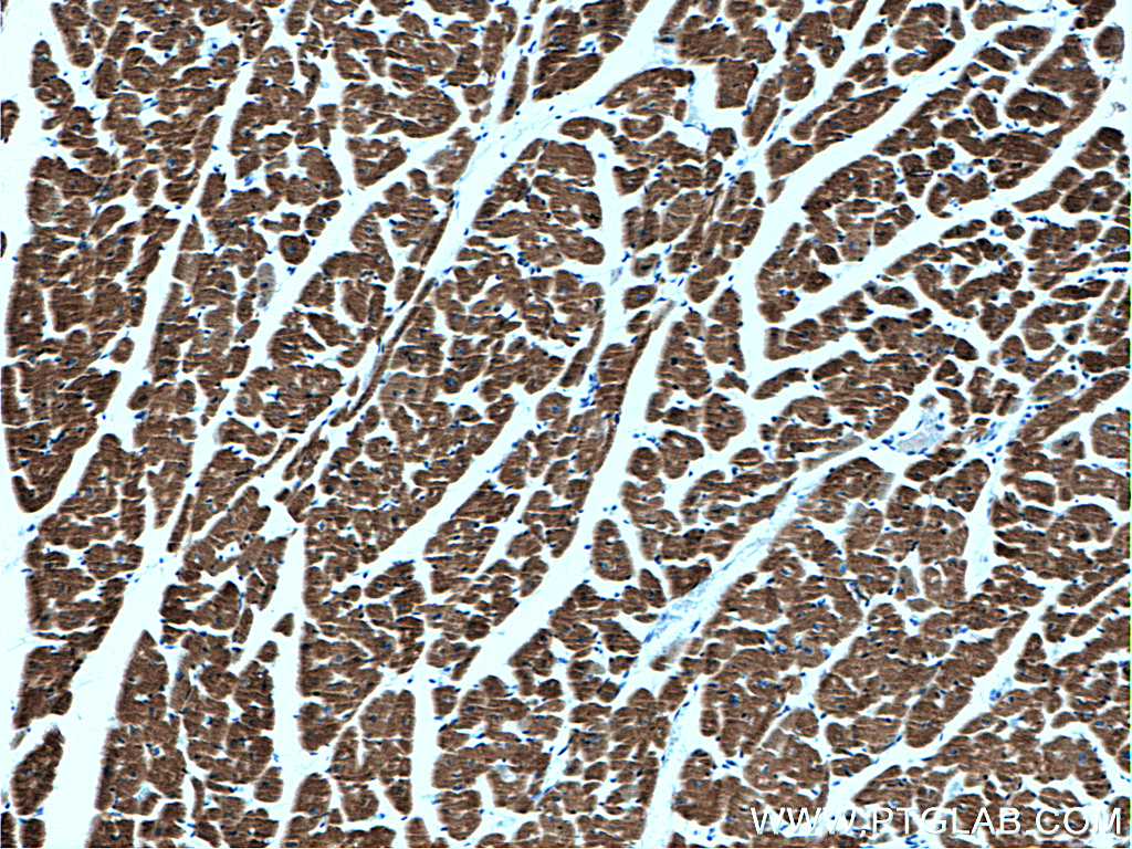 IHC staining of human heart using 60229-1-Ig