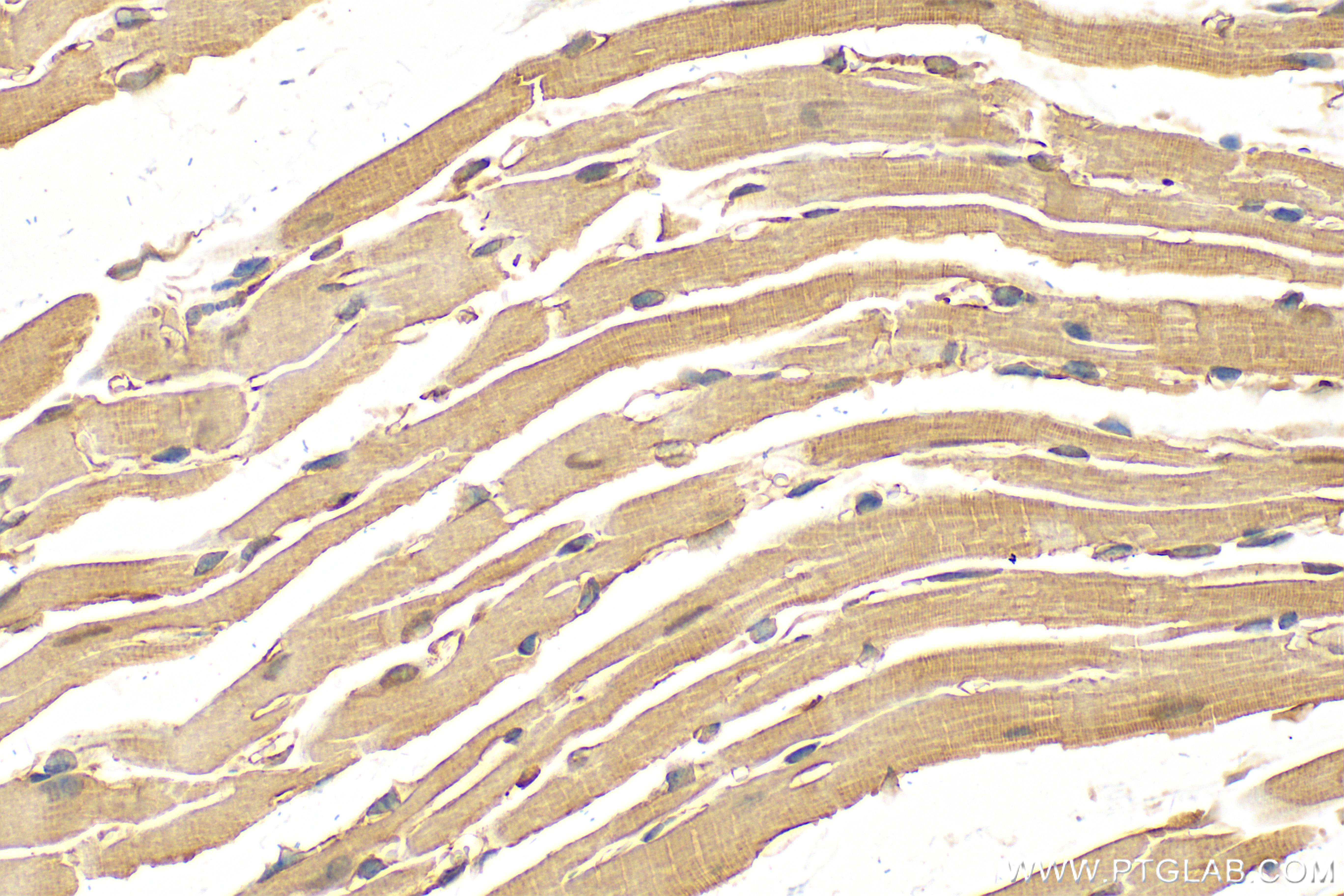 IHC staining of mouse heart using 18158-1-AP