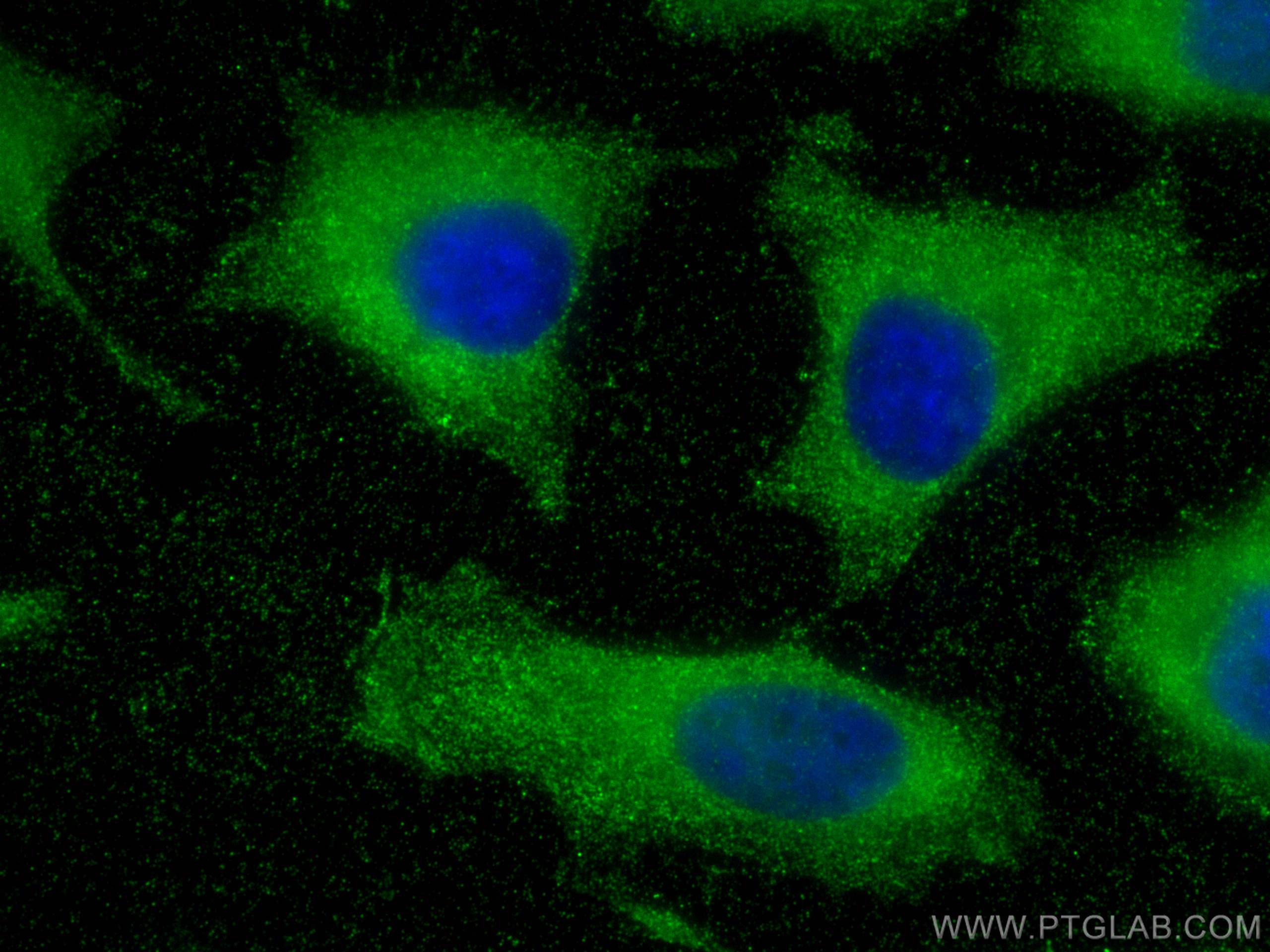 IF Staining of HeLa using 68142-1-Ig (same clone as 68142-1-PBS)