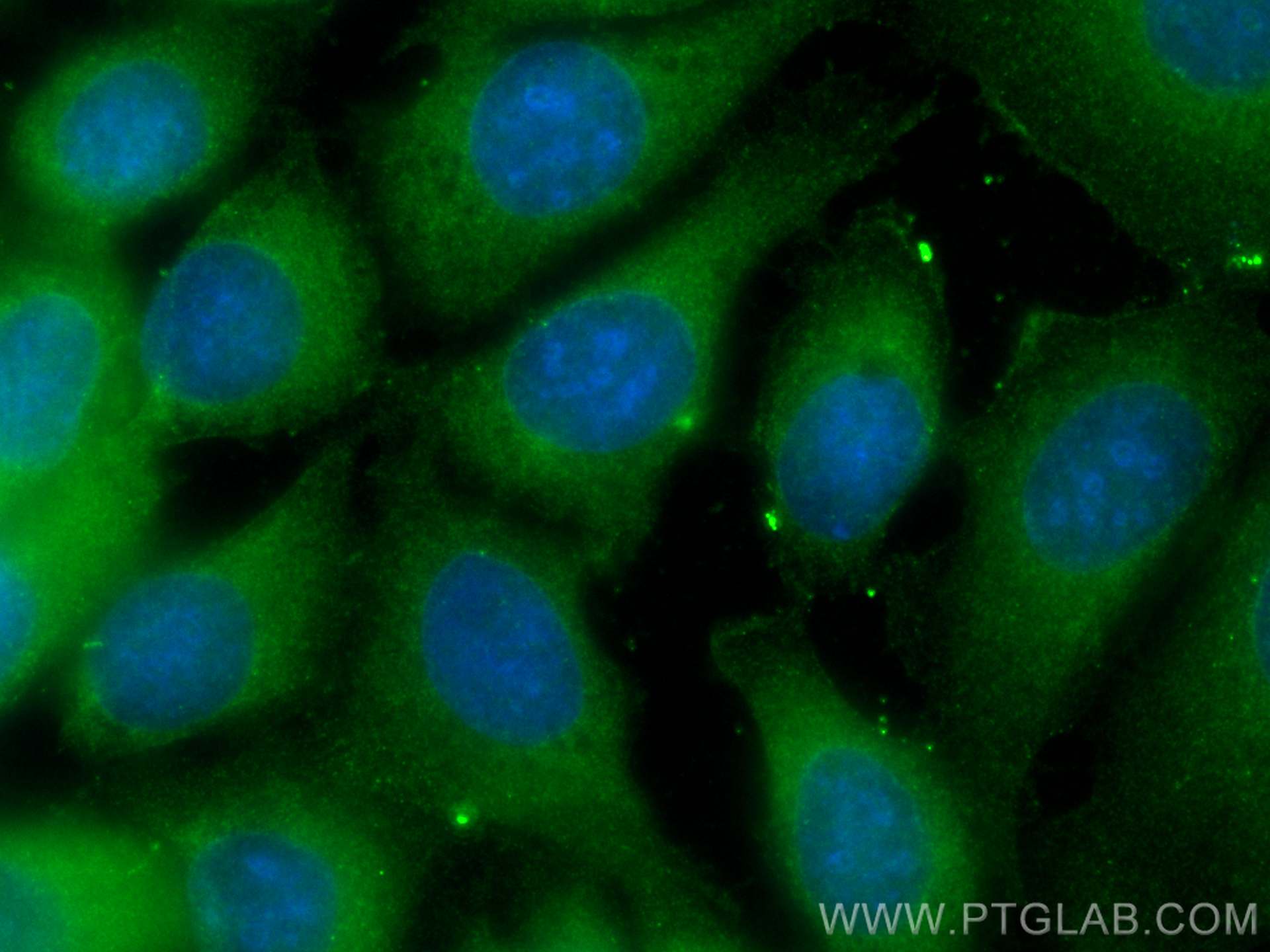 IF Staining of MCF-7 using CL488-15354