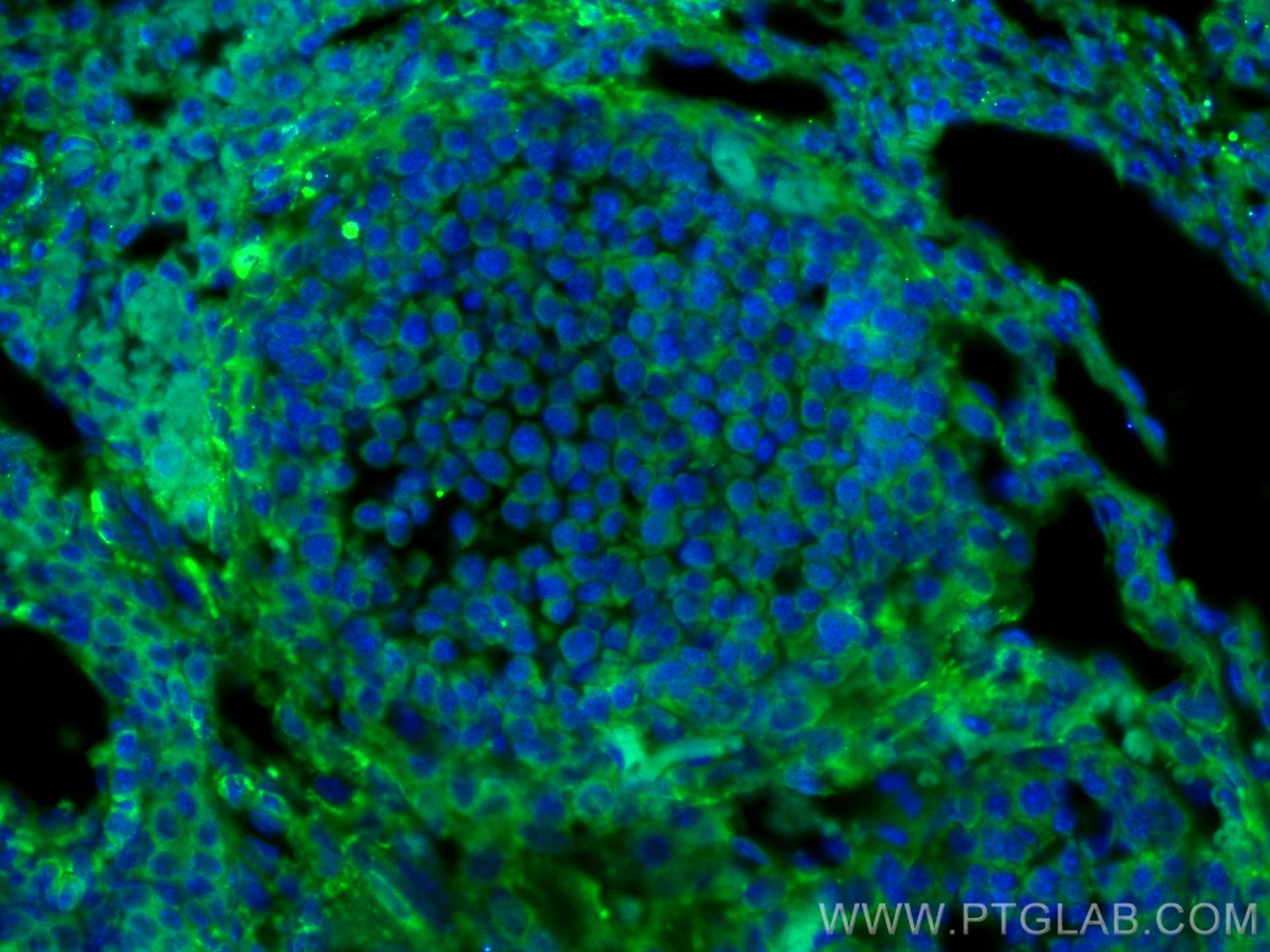 IF Staining of mouse ovary using 21642-1-AP