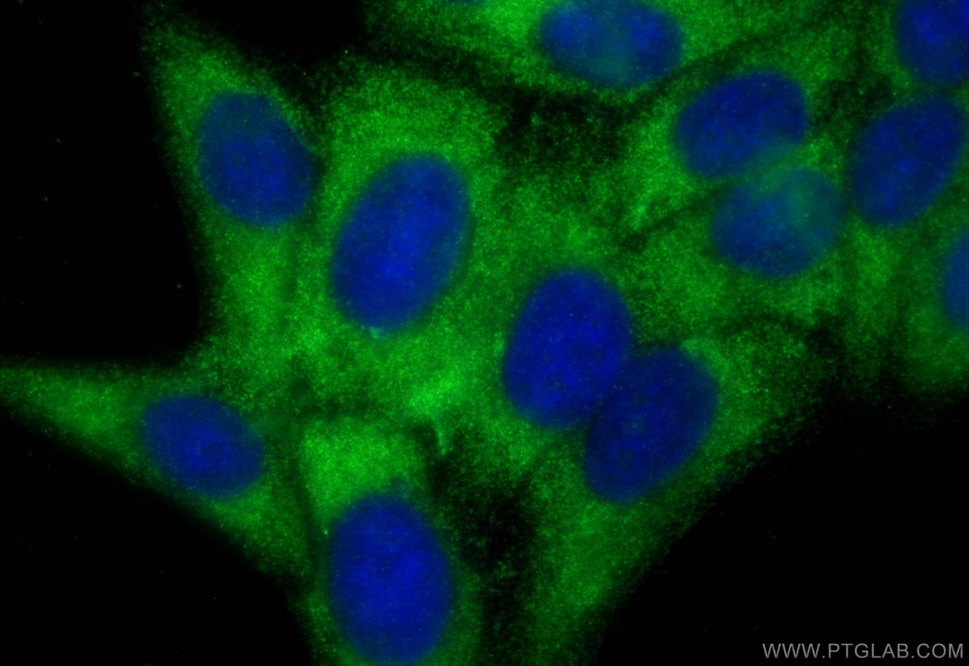 IF Staining of HepG2 using 21642-1-AP