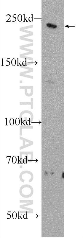 WB analysis of rat brain using 25104-1-AP (same clone as 25104-1-PBS)