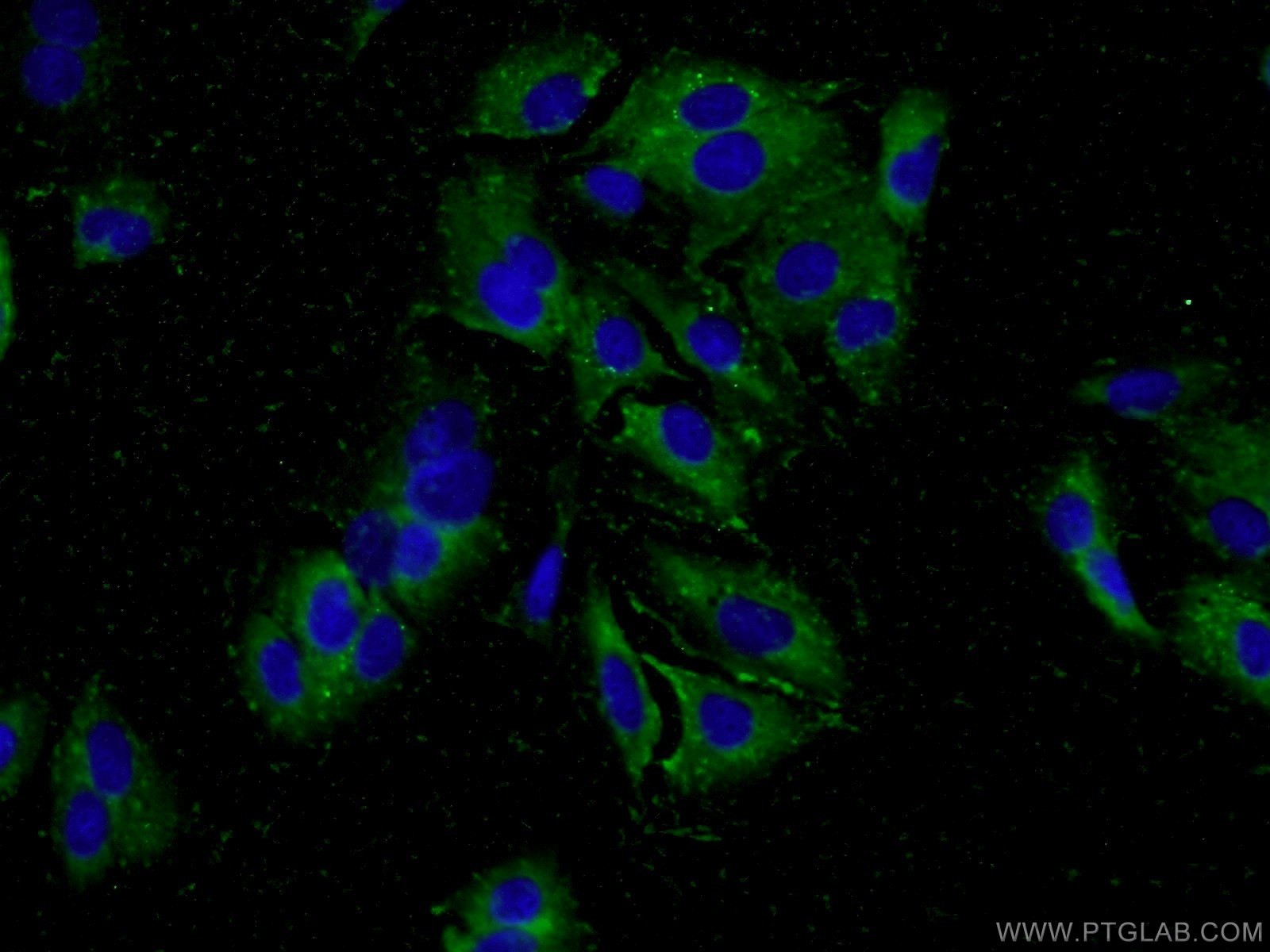 IF Staining of A549 using 23906-1-AP