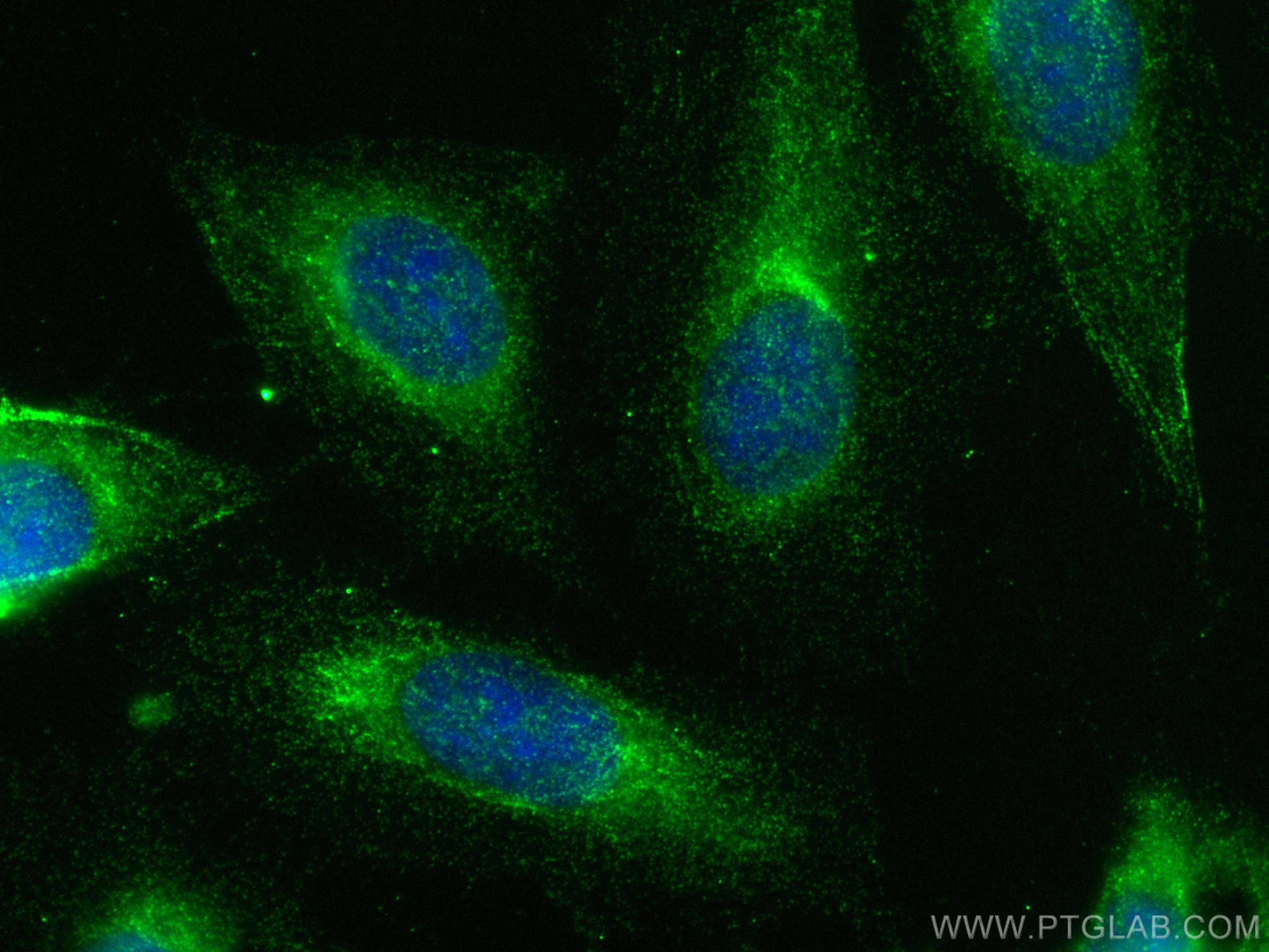 IF Staining of U2OS using 17969-1-AP