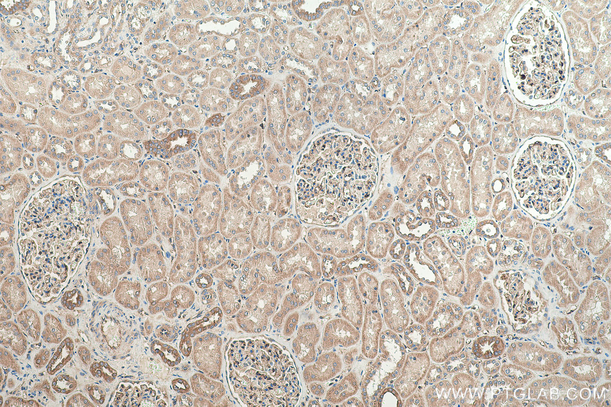 IHC staining of human kidney using 17969-1-AP