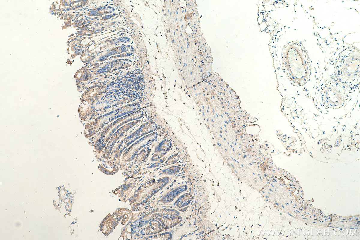 IHC staining of mouse colon using 17969-1-AP