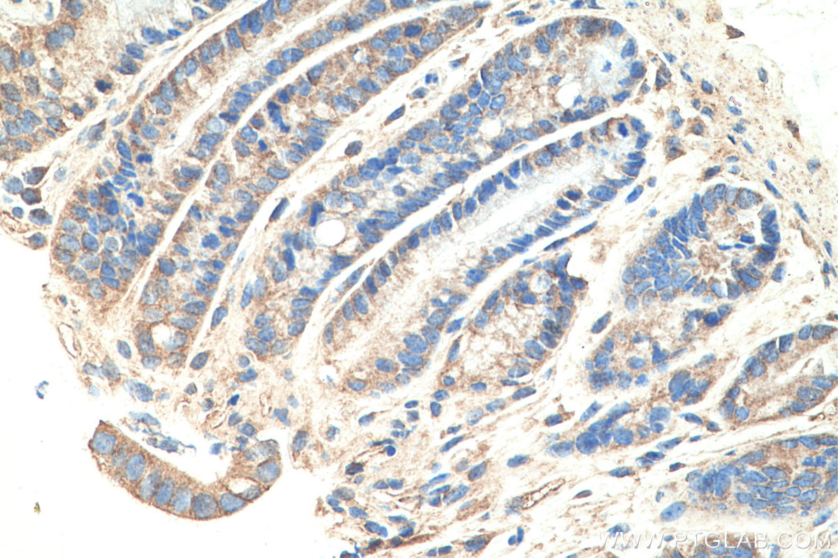 IHC staining of mouse colon using 17969-1-AP