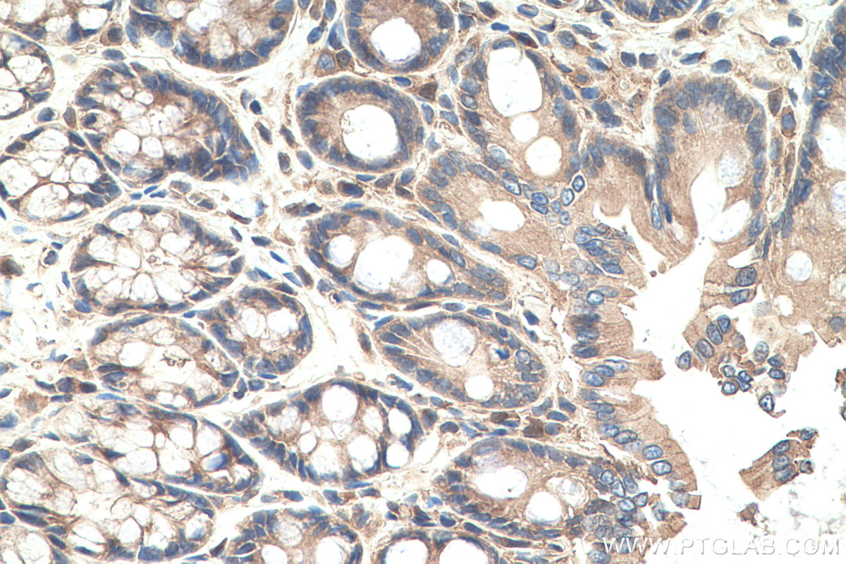 IHC staining of rat colon using 17969-1-AP