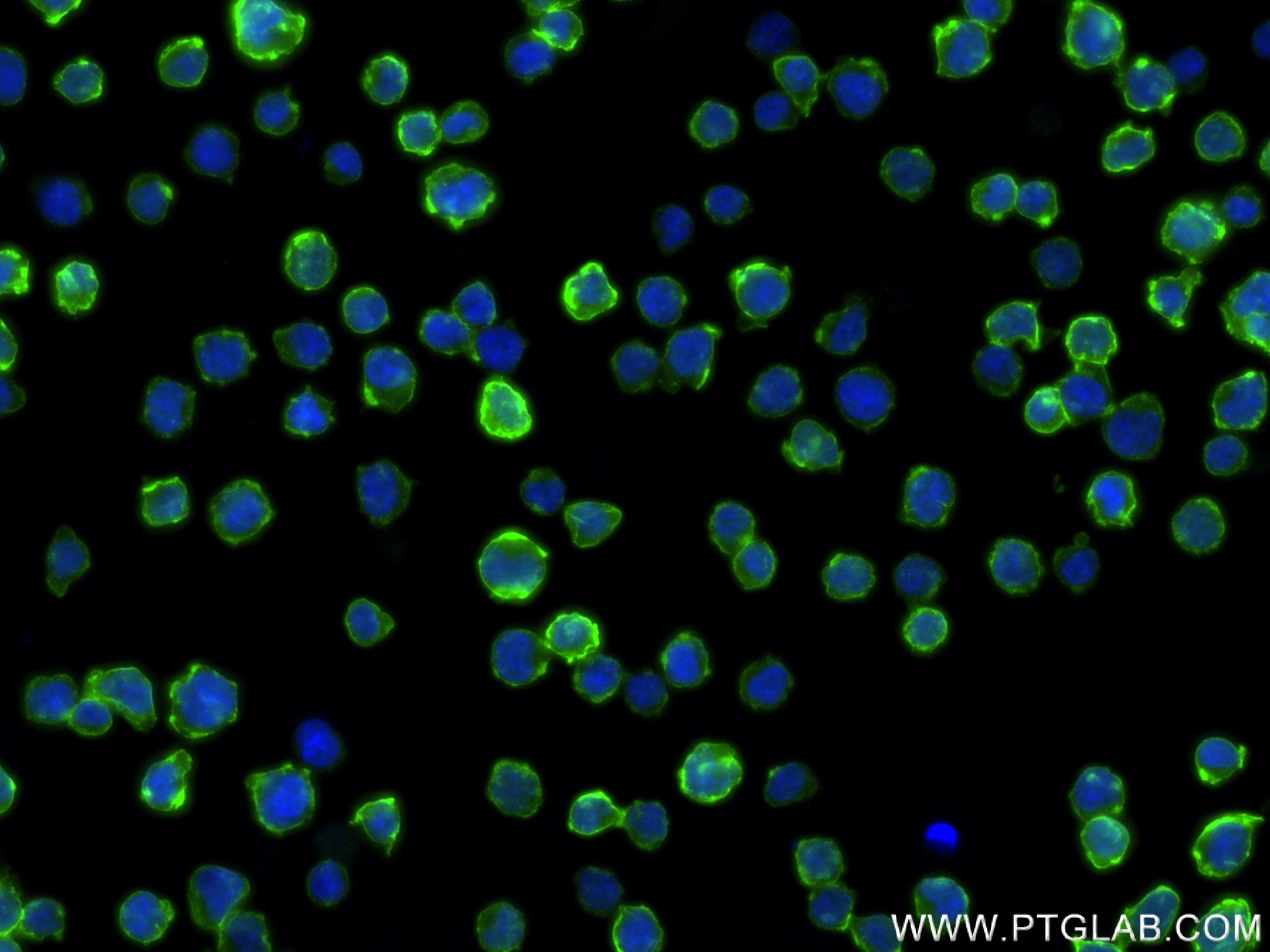 IF Staining of Jurkat using 83556-5-RR (same clone as 83556-5-PBS)