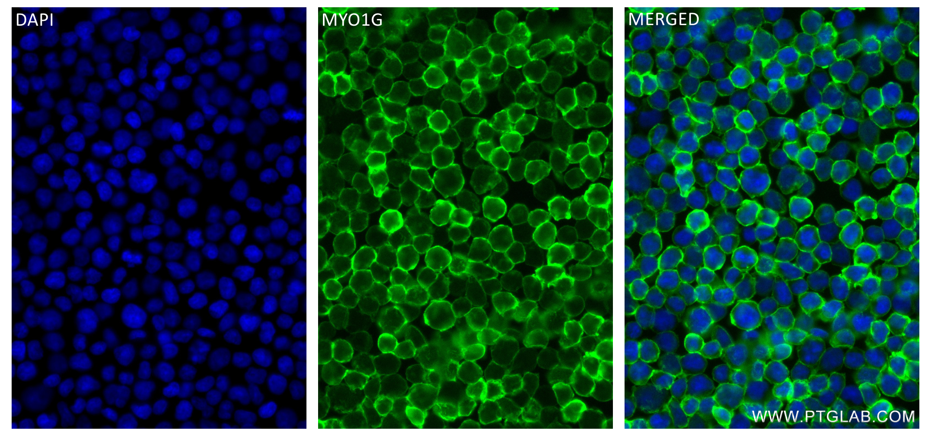 IF Staining of Jurkat using 83556-5-RR (same clone as 83556-5-PBS)