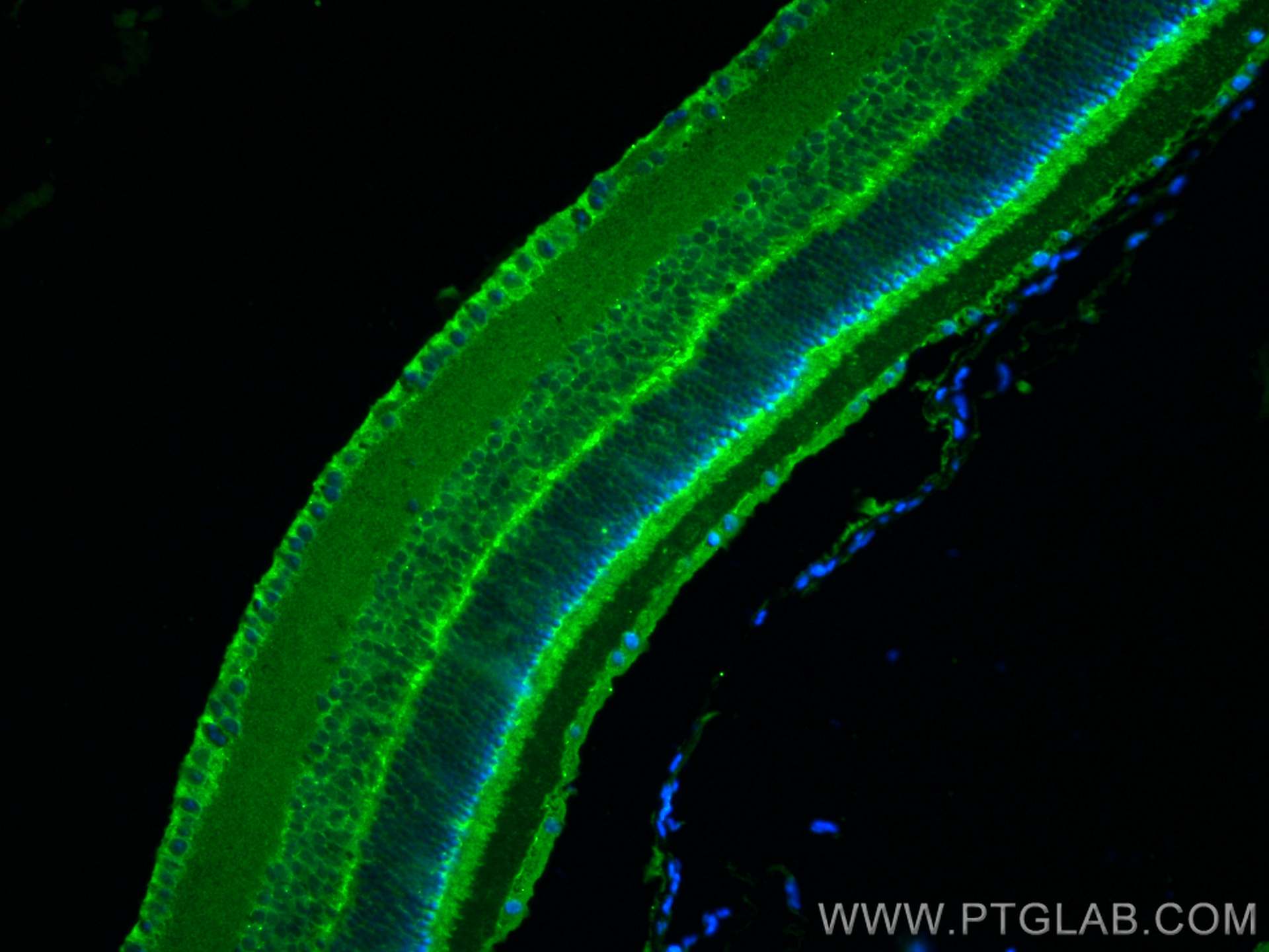 IF Staining of mouse eye using 28562-1-AP