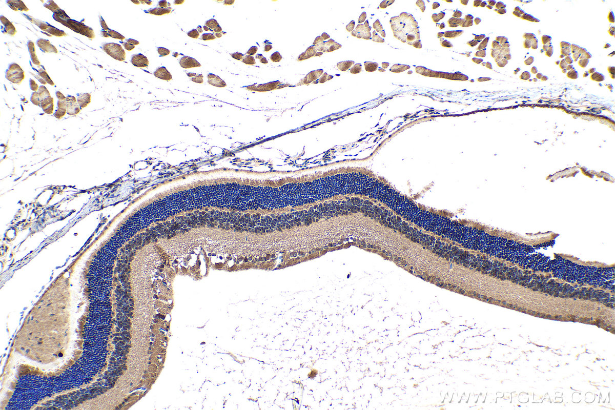 IHC staining of mouse eye using 28562-1-AP