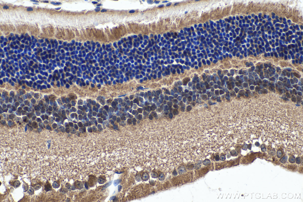 IHC staining of mouse eye using 28562-1-AP